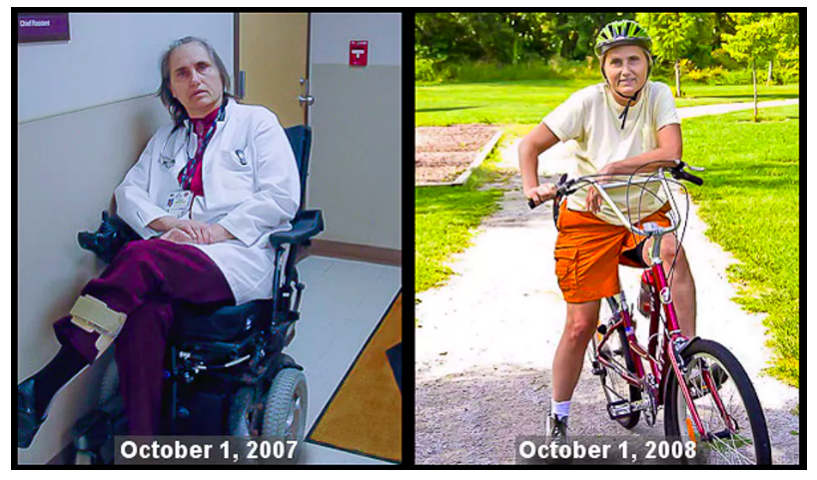 Terry Wahls before and after she changed her Multiple schlerosis diet.