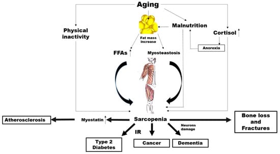 Potential mechanisms linking aging, sarcopenia and noncommunicable diseases (NCDs). FFAs: free fatty acids, IR: insulin resistance..